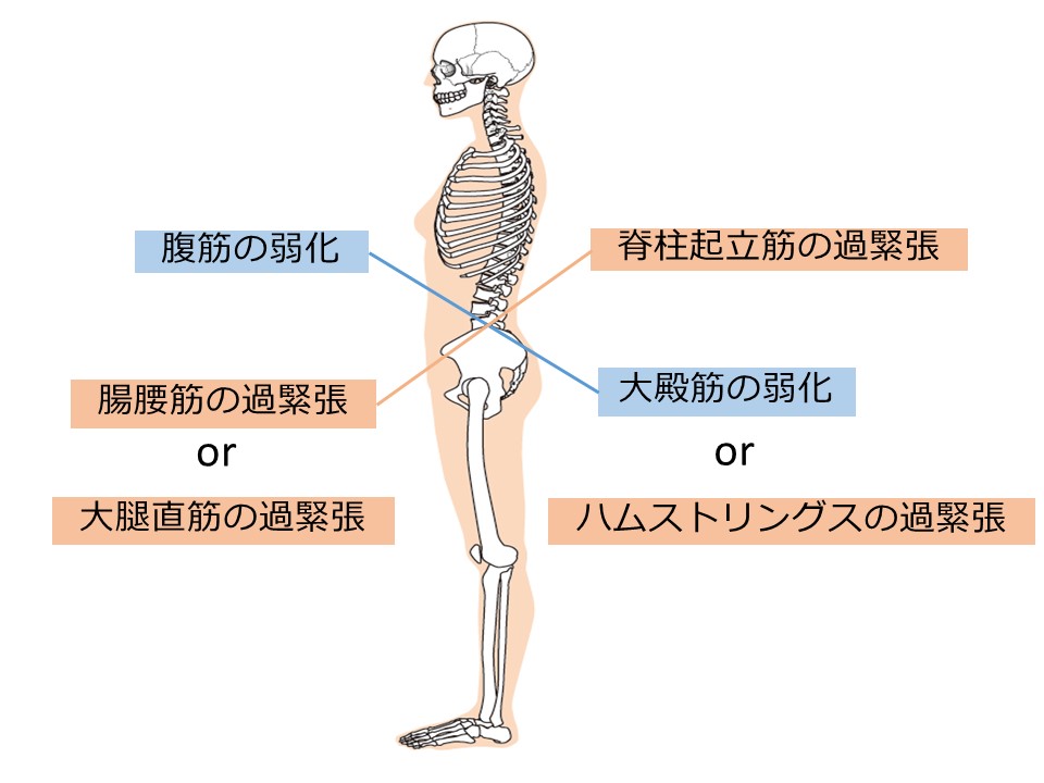 立位姿勢の緊張