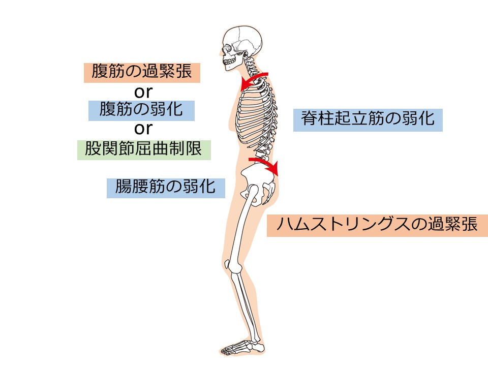 ●アライメント