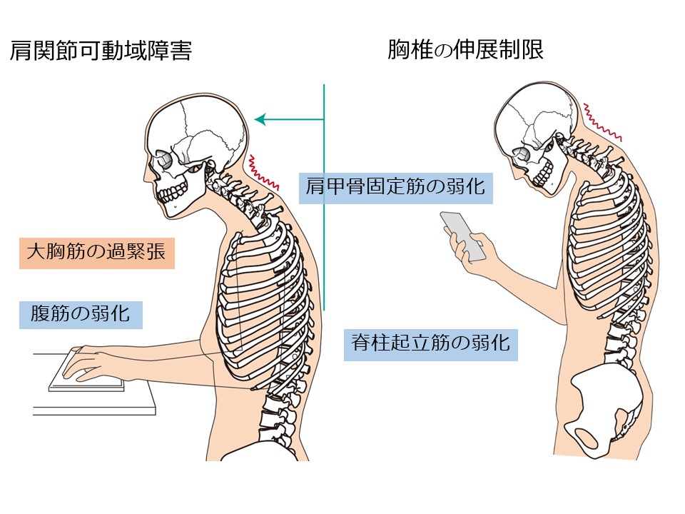 骨格説明