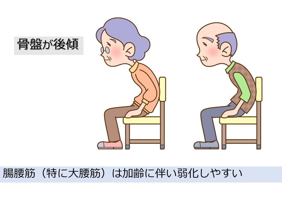 骨盤後傾座位イラスト